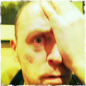 One-eyed man